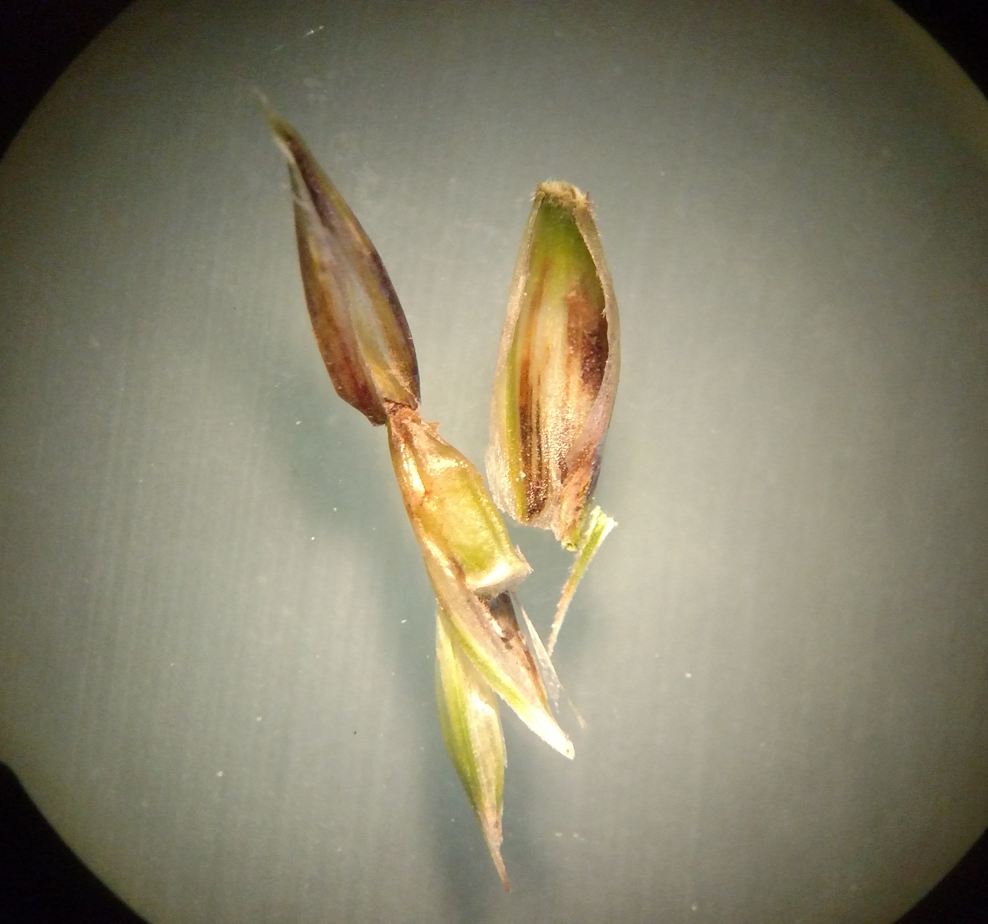 black chaff and kernel under microscope